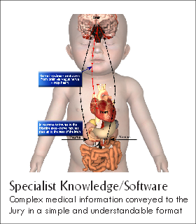Specialist Knowledge/Software
Complex medical information conveyed to the
Jury in a simple and understandable format