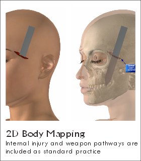 2D Body Mapping
Internal injury and weapon pathways are
included as standard practice