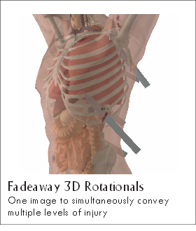 Fadeaway 3D Rotationals
One image to simultaneously convey
multiple levels of injury
