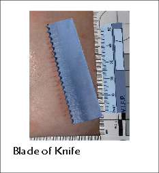 Blade of Knife
