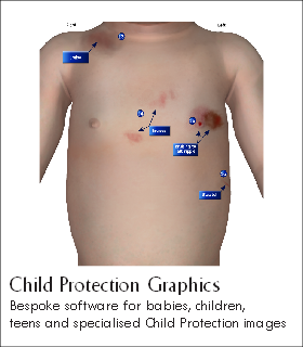 Child Protection Graphics
Bespoke software for babies, children,
teens and specialised Child Protection images