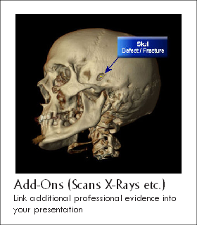 Add-Ons (Scans X-Rays etc.)
Link additional professional evidence into
your presentation